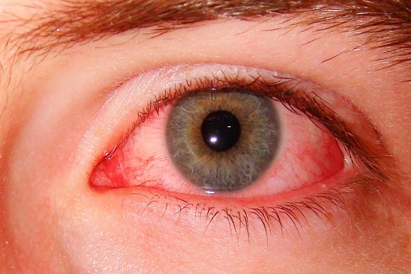 feeling unwell