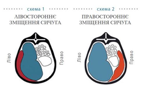 расељавање абомазума у ​​крава