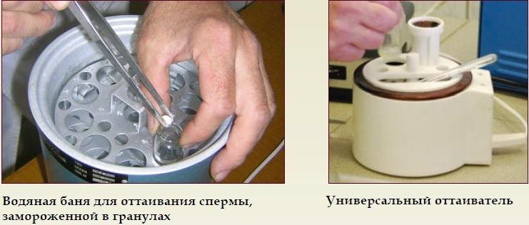 замръзване на сперма